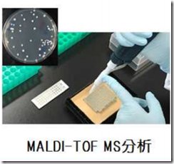 食中毒を起こす微生物 セレウス菌の迅速検出法の開発に成功