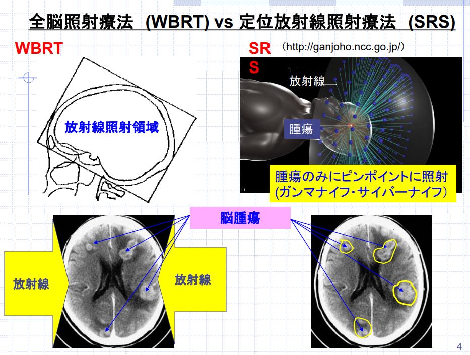 放射線照射による遅発性認知機能障害を低減