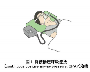 「睡眠時無呼吸症候群と認知症」