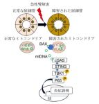 急性腎障害(AKI)における炎症の新しいメカニズムを解明 急性腎障害(AKI)における炎症の新しいメカニズムを解明