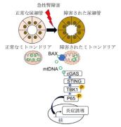 急性腎障害（AKI）における炎症の新しいメカニズムを解明