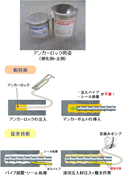 アンカーロック   (CB-110015-VE)