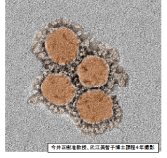 新型コロナウイルス感染症(COVID-19)の病態解明/予防・治療法の開発