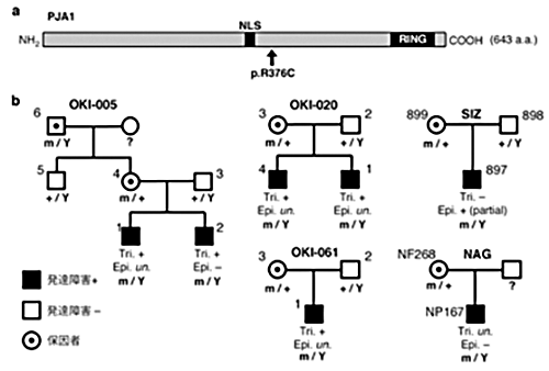 三角頭蓋を伴う発達障害の新規責任遺伝子を発見