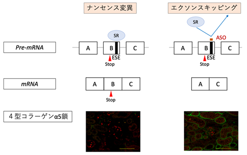 アルポート症候群に対する核酸医薬を用いた新規治療法開発