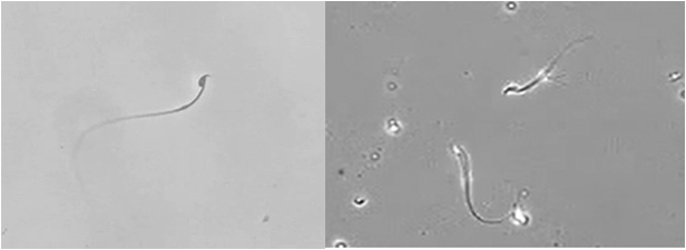 体外受精の成功率を高める精子の選別技術を開発