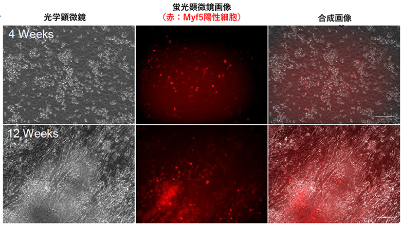 筋ジストロフィーモデルマウスにおけるヒトiPS細胞由来骨格筋幹細胞の移植効果を確認