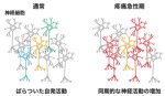 痛みを感じた時の脳内の神経回路変化を ホログラフィック顕微鏡によって解明