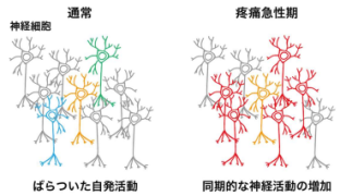 痛みを感じた時の脳内の神経回路変化を ホログラフィック顕微鏡によって解明