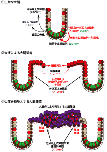 大腸分泌系上皮細胞の可塑性による新たな組織再生・腫瘍発生機構を解明