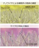 尿中マイクロRNAから「がん」を特定