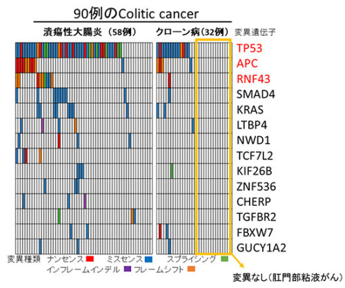 炎症性腸疾患からの発がん機構の解明～Colitic cancerのゲノム解析～
