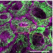 がん細胞の接着を回復させる機構-アクトミオシン収縮による細胞境界面の張力が誘導-