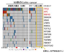 炎症性腸疾患からの発がん機構の解明～Colitic cancerのゲノム解析～