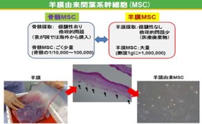 世界初!クローン病や急性GVHDに対する新たな細胞治療