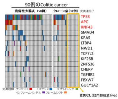 炎症性腸疾患からの発がん機構の解明～Colitic cancerのゲノム解析～