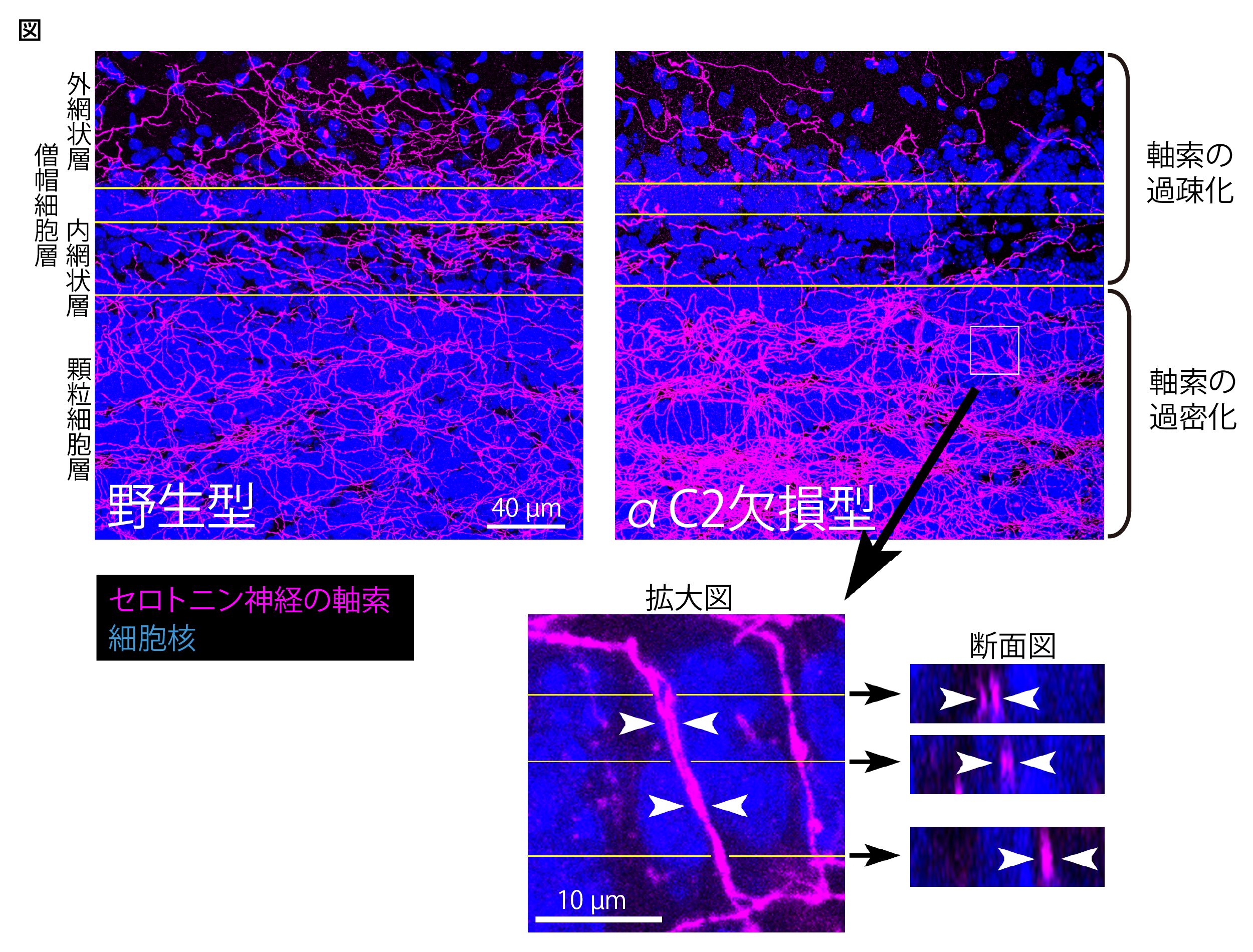 脳全体にセロトニン神経軸索を分散させるしくみ