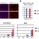 iPS細胞から高効率で安定的な骨格筋細胞を作製する方法を開発