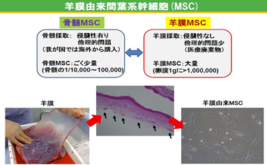 世界初!クローン病や急性GVHDに対する新たな細胞治療