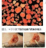 糖尿病の膵島移植治療に画期的移植法を開発～従来法の課題を全て克服する新規皮下移植法～