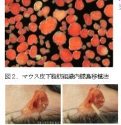 糖尿病の膵島移植治療に画期的移植法を開発～従来法の課題を全て克服する新規皮下移植法～