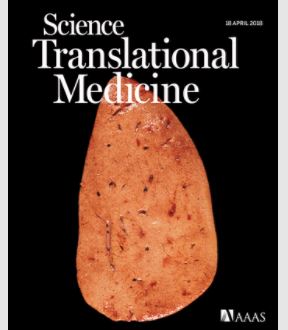 デュシェンヌ型筋ジストロフィー治療薬(NS-065/NCNP-01)の医師主導による早期探索的臨床試験結果