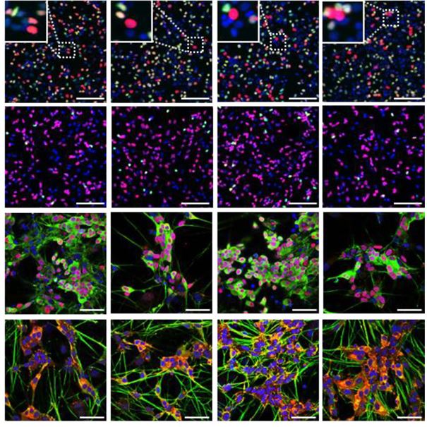 ヒト多能性幹細胞から高効率に交感神経細胞を分化誘導する方法を開発