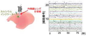 世界初・自由行動環境下における霊長類の大脳皮質深部の多細胞活動の計測に成功