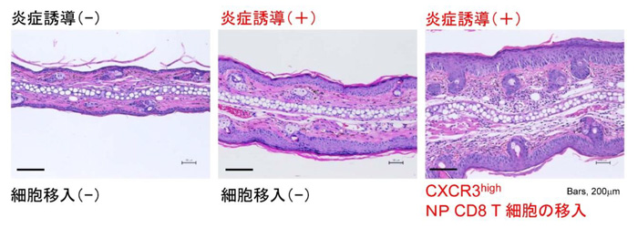 自律的な免疫細胞の増殖により、免疫反応を増強するT細胞の割合が増えることを発見
