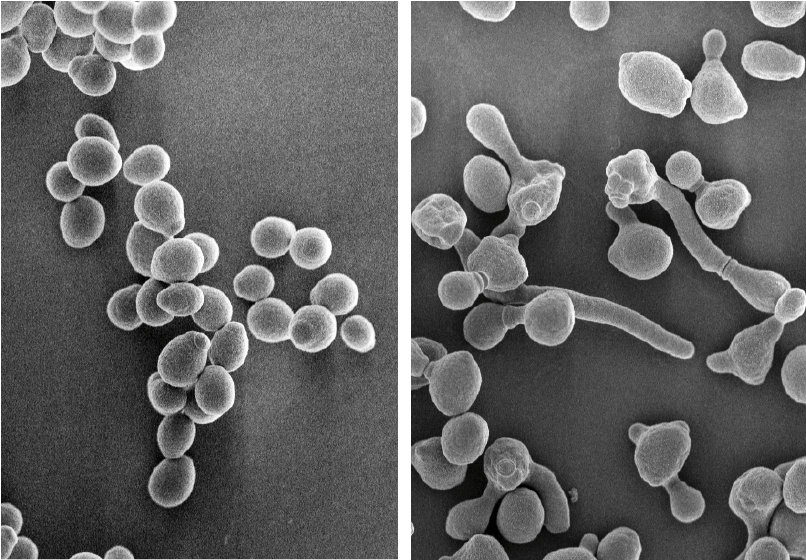 カンジダ感染症における不快情動を惹起する分子メカニズムの解明