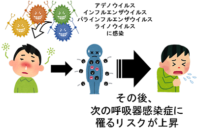 特定のウイルスに感染した後、呼吸器感染症のリスクが上昇することを発見
