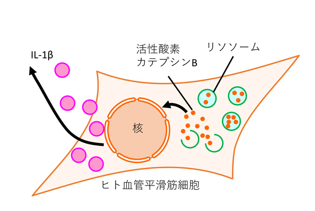 リソソーム膜の透過性亢進がヒト血管平滑筋細胞の炎症を誘導する