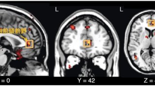 自閉スペクトラム症の治療薬候補であるオキシトシンの投与方法による効果の違いの一端を解明