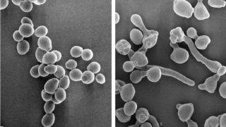 カンジダ感染症における不快情動を惹起する分子メカニズムの解明