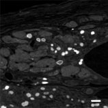 マウスの心臓に移植したヒトiPS細胞由来心筋細胞のナノ構造の評価に成功