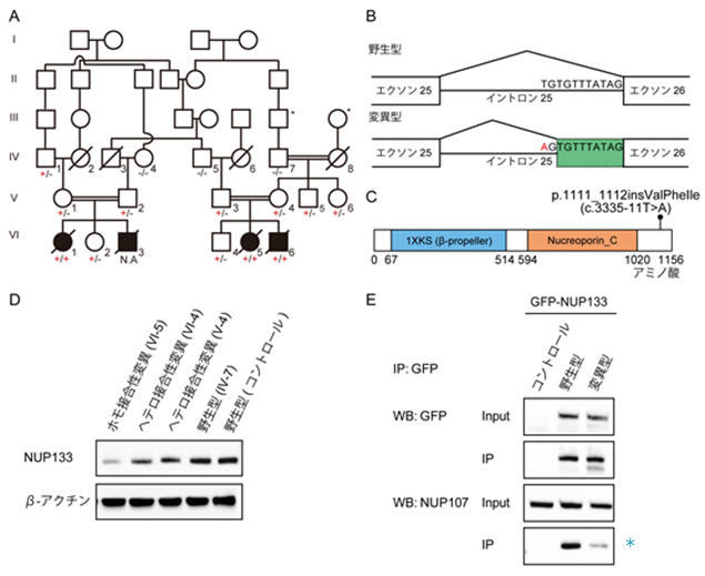 ギャロウェイ・モワト症候群の新たな原因遺伝子を発見