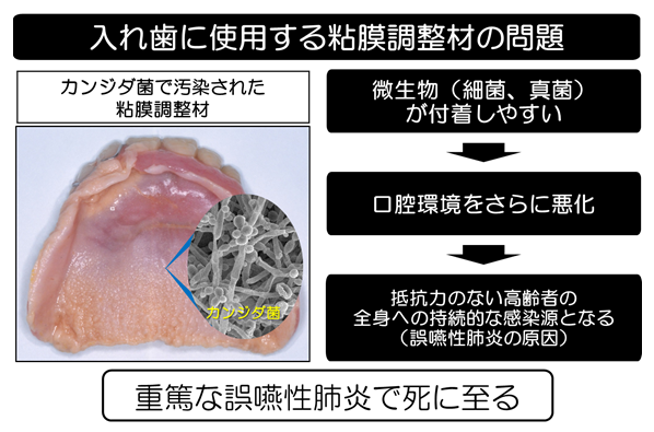 「新入れ歯用粘膜治療材」を開発！製造販売を厚生労働大臣が承認