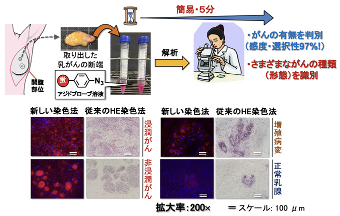 有機合成反応で乳がん手術を改革～迅速・簡易・安価な手術中がん診断技術を世界基準へ～