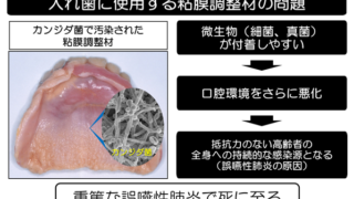 「新入れ歯用粘膜治療材」を開発！製造販売を厚生労働大臣が承認