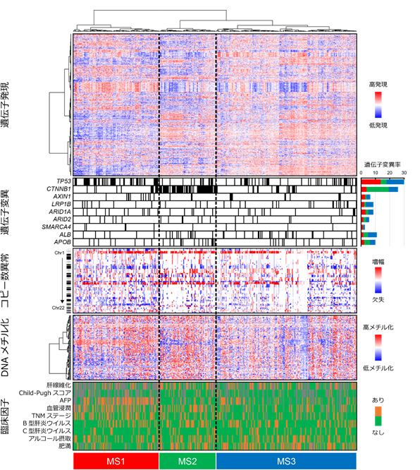 肝細胞癌の分子生物学的・免疫学的サブタイプ分類を確立