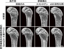 エストロゲンが骨細胞のSema3Aを介して骨の恒常性を維持するしくみを解明