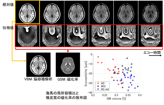 認知症早期診断に向け、MRIシステムによる撮像・解析技術を開発