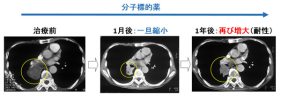 肺がん細胞が分子標的薬から生き延びるメカニズムを解明！