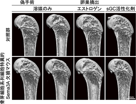 エストロゲンが骨細胞のSema3Aを介して骨の恒常性を維持するしくみを解明