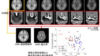 認知症早期診断に向け、MRIシステムによる撮像・解析技術を開発