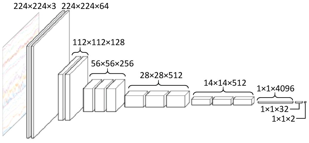 人工知能で脳波からてんかん発作を自動検出