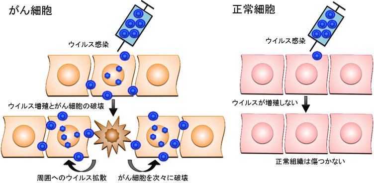 脳腫瘍に対するウイルス療法の医師主導治験で高い治療効果を確認