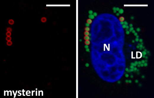 もやもや病の責任遺伝子が脂肪代謝の制御因子であることを発見