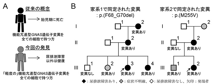 出生できないと考えられていた機能亢進型GNAS遺伝子異常が 新たな遺伝性腎疾患の原因
