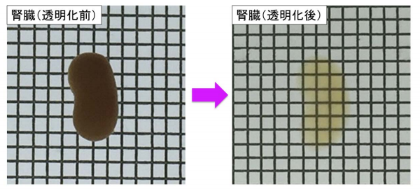 臓器透明化(CUBIC)を用いて腎臓全体の交感神経系の 3 次元構造を可視化し、その機能障害を解析
